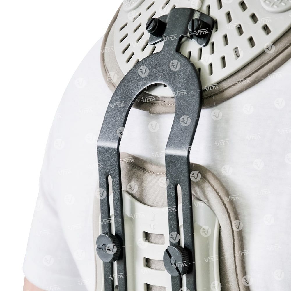 Alternative view of Νάρθηκας «MINERVA VI» 01-2-030