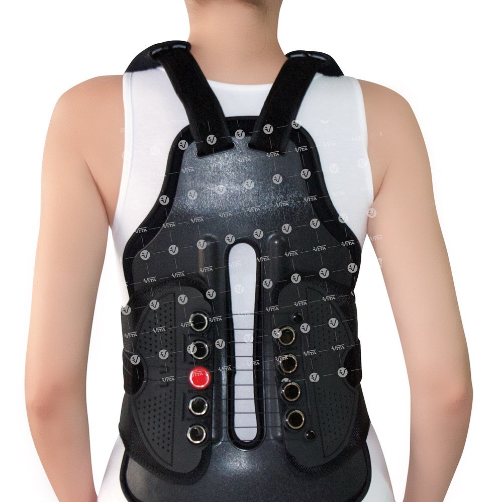 Alternative view of Νάρθηκας θωρακοοσφυϊκός «OT-TLSO» 04-2-007